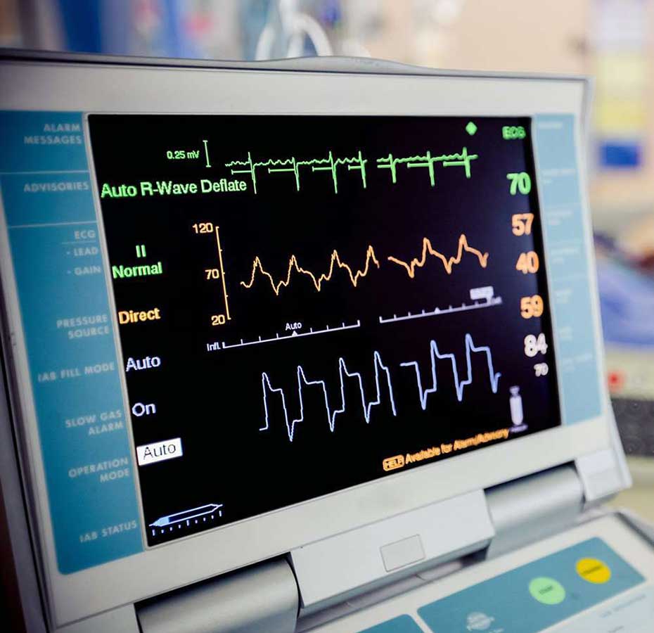 ecg_machine